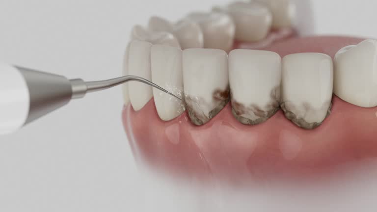Reliable Tooth Extraction contractor in Sumter, SC by Smile Center Dentistry